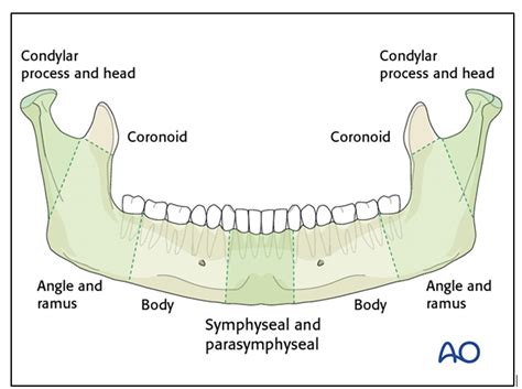 Mandibular Fracture Classification