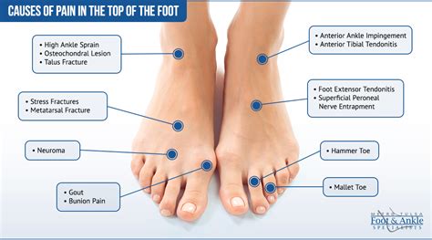 Foot Pain Chart | Metro Tulsa Foot & Ankle