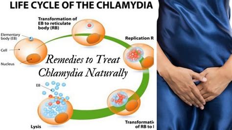 7 Best Home Remedies to Treat Chlamydia Naturally