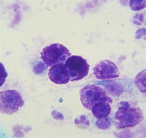 File:Mast cell tumor cytology 2.JPG - Wikipedia, the free encyclopedia