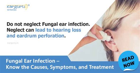 Causes, symptoms and treatment of fungal ear infection