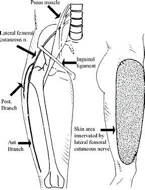 Lateral Femoral Cutaneous Nerve Entrapments | Manual Therapy ...