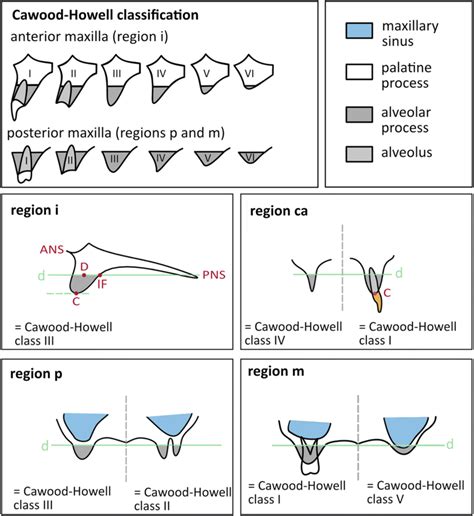 Cawood and Howell classification and anatomic dental chartings of ...