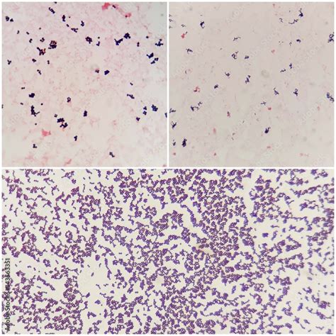 Cocci And Bacilli