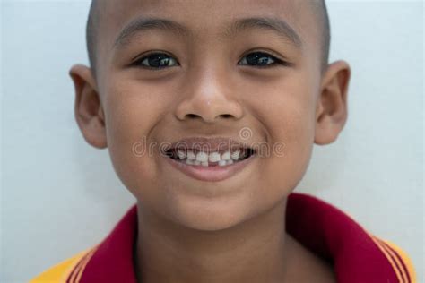 Little Boy Smiling with Broken Teeth Stock Image - Image of close ...