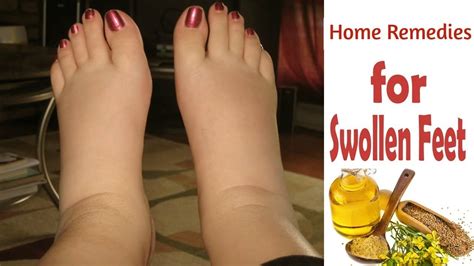 Top 5 Effective Home Remedies For Swollen Feet And Ankle Morpheme ...