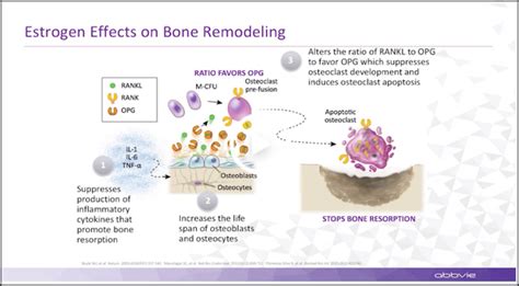 Bone Health | Women’s Health Education | Digital OBGYN