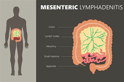 Mesenteric Lymph Nodes Location