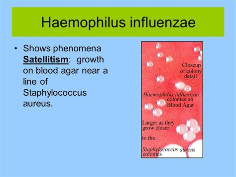 Antibiotics for haemophilus