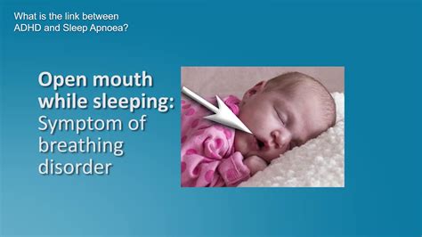 Sleep Apnea Symptoms In Infants