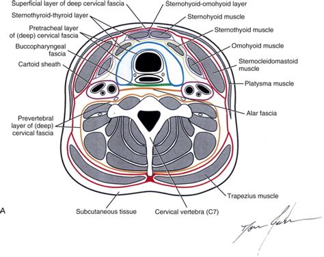 Ludwig’s Angina | Pocket Dentistry