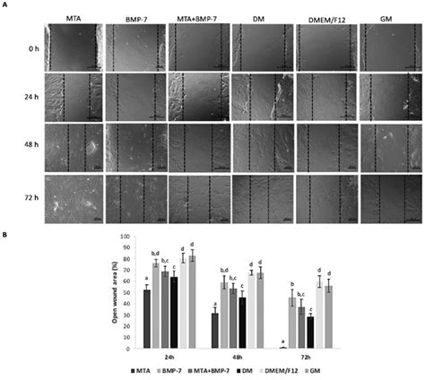 Wound healing assay results. A) Phase-contrast microscope images ...