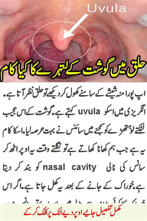 Swollen Uvula: Causes and Treatment for Uvulitis | Daily