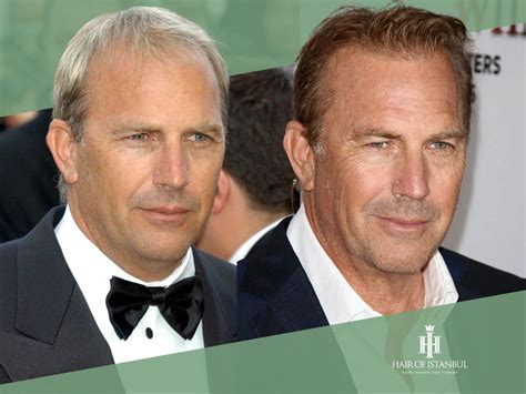 Kevin Costner Hair Transplant: A Closer Look His New Hair