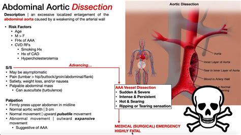 Abdominal Aortic Aneurysm (AAA) | Presentation, Risk Factors, & Signs ...