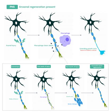 2.1: Acute Physical Damage to the Nervous System - Medicine LibreTexts