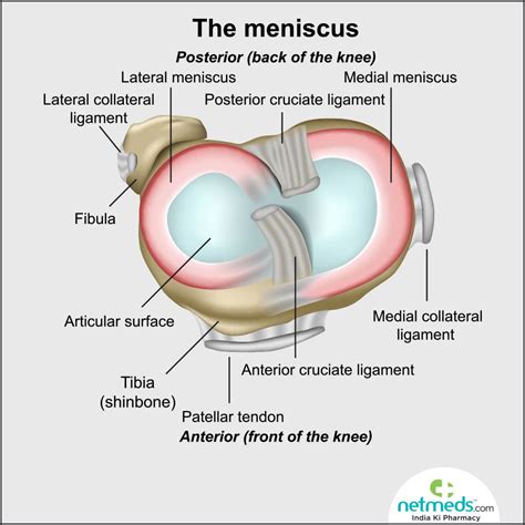 Torn Meniscus: Causes, Symptoms And Treatment | Netmeds