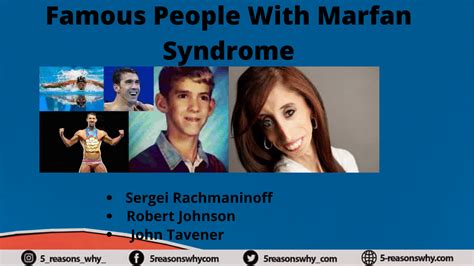 Famous People With Marfan Syndrome including different celebrities ...