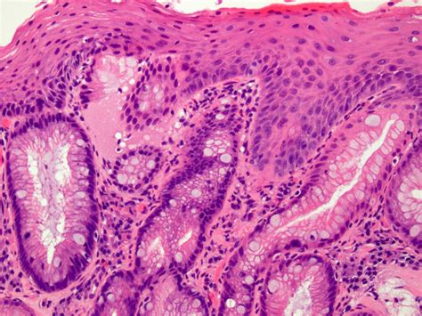 Esophagus Histology