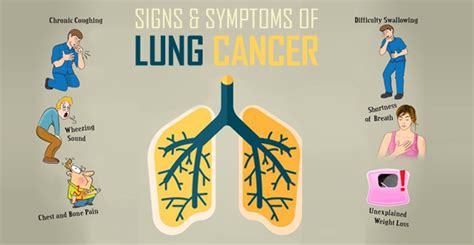 The Symptoms of Lung Cancer in Males and Females