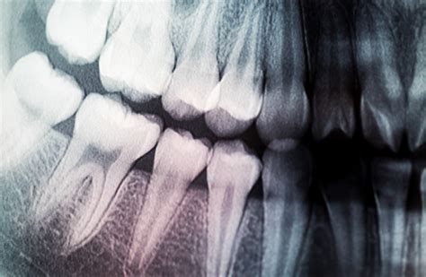 Maxilla Bone - The Definitive Guide | Biology Dictionary