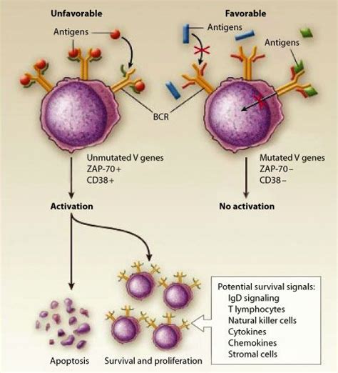 chronic lymphocytic leukemia stages | Leukemia | Pinterest