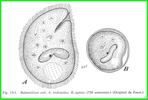 Parasitology World: BALANTIDIUM COLI