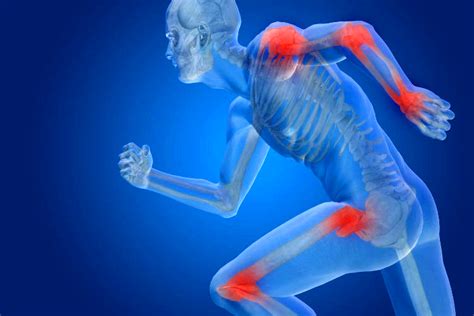 Joint Pain: Causes, Symptoms, And Remedies - UMGeeks