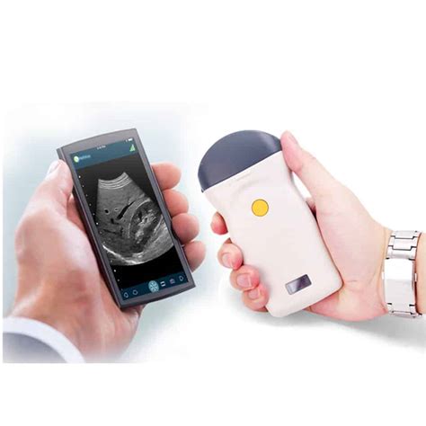 Mobile Ultrasound Devices – Horse Racing Sense