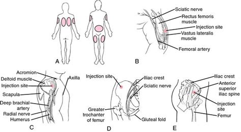 Intravenous Injection Sites