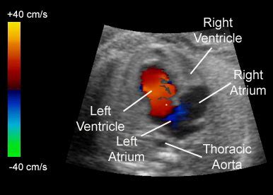 4D Color Ultrasound – Vikas Diagnostics