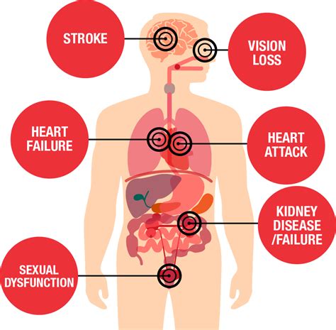 Health Threats from High Blood Pressure | American Heart Association