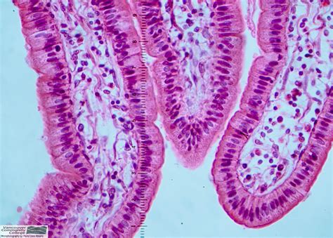 Small Intestine (COLUMNAR EPITHELIUM) @HPO MAG by Spyrogenes on DeviantArt