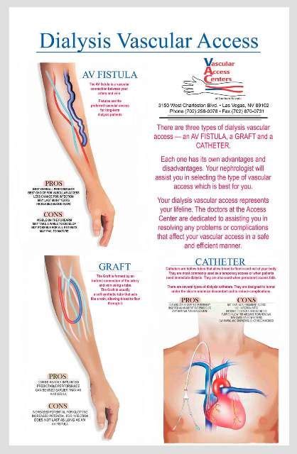 diaysis access illustrations | Hemodialysis Grafts - Registered ...