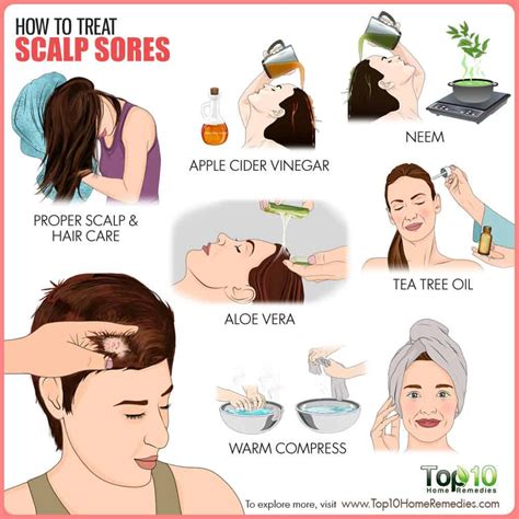 How to Treat Scalp Sores - eMediHealth | Dry scalp treatment, Sores on ...