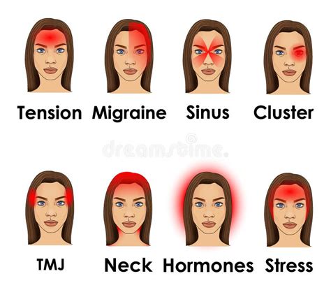 Types of Headache Illustrated on a Woman Face Stock Vector ...