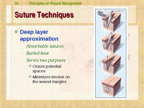 Wound Management unc emergency Medicine