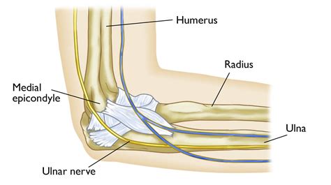 Ulnar Nerve Entrapment at the Elbow (Cubital Tunnel Syndrome ...