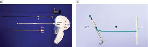 The Prostatic Urethral Lift Procedure Using UroLift Implants: Novel ...