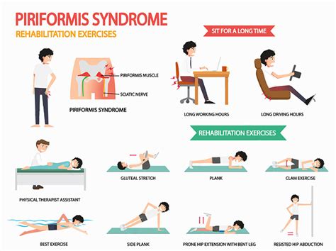 Relieve Piriformis Syndrome With Chiropractic Care