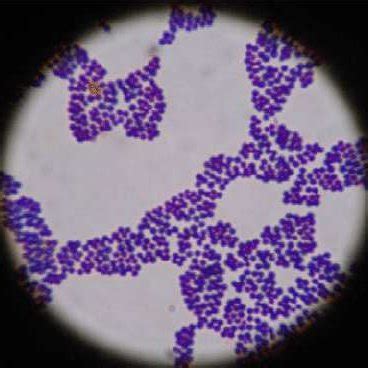 Staphylococcus aureus under microscope. Adapted from (Foster, 2017 ...