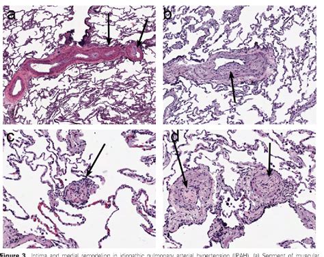 Pulmonary Artery Histology
