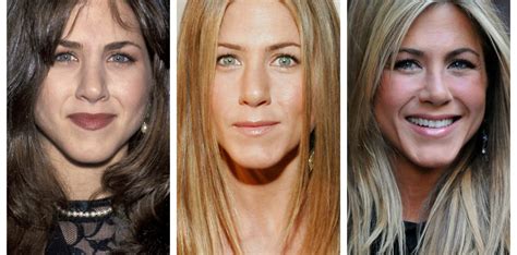 Jennifer Aniston's Plastic Surgery: See Her Nose Job Before and After Pics!