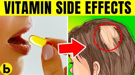 9 Side Effects Of Having Too Many Vitamins - YouTube