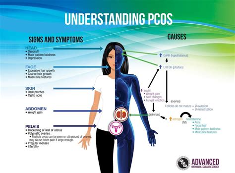 Image result for pcos body | Pcos, Polycystic ovarian syndrome ...