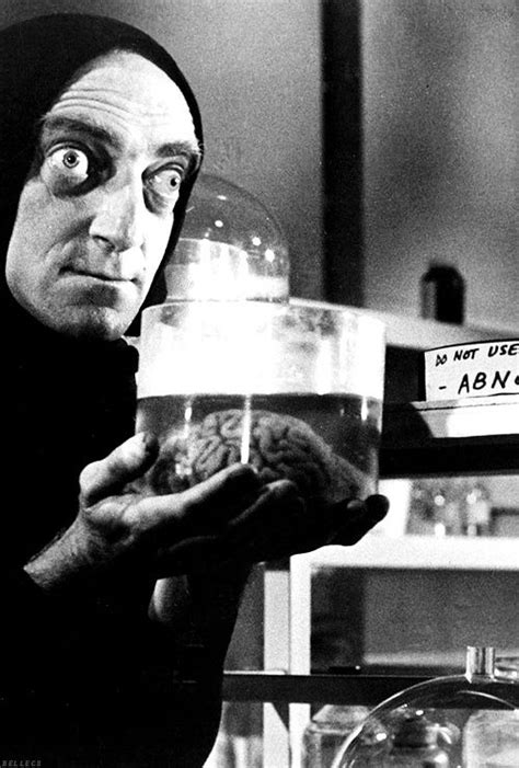 Young Frankenstein (1974) - Marty Feldman as Igor - "Abby Normal ...