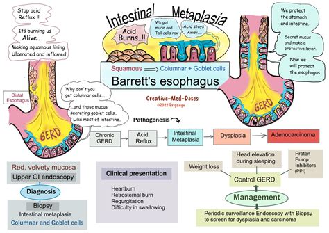 Barrett’s esophagus - Creative Med Doses