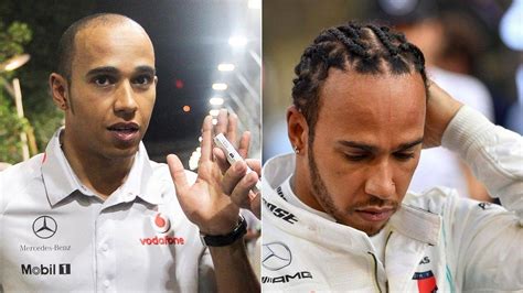 Lewis Hamilton Hair Transplant: Did Mercedes star get a transplant to ...