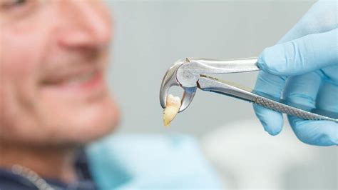 Advantages of Non-Surgical Tooth Extraction | 7DMC