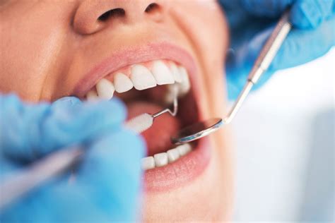 Oral Thrush Treatment Over-the-Counter Options and Advice